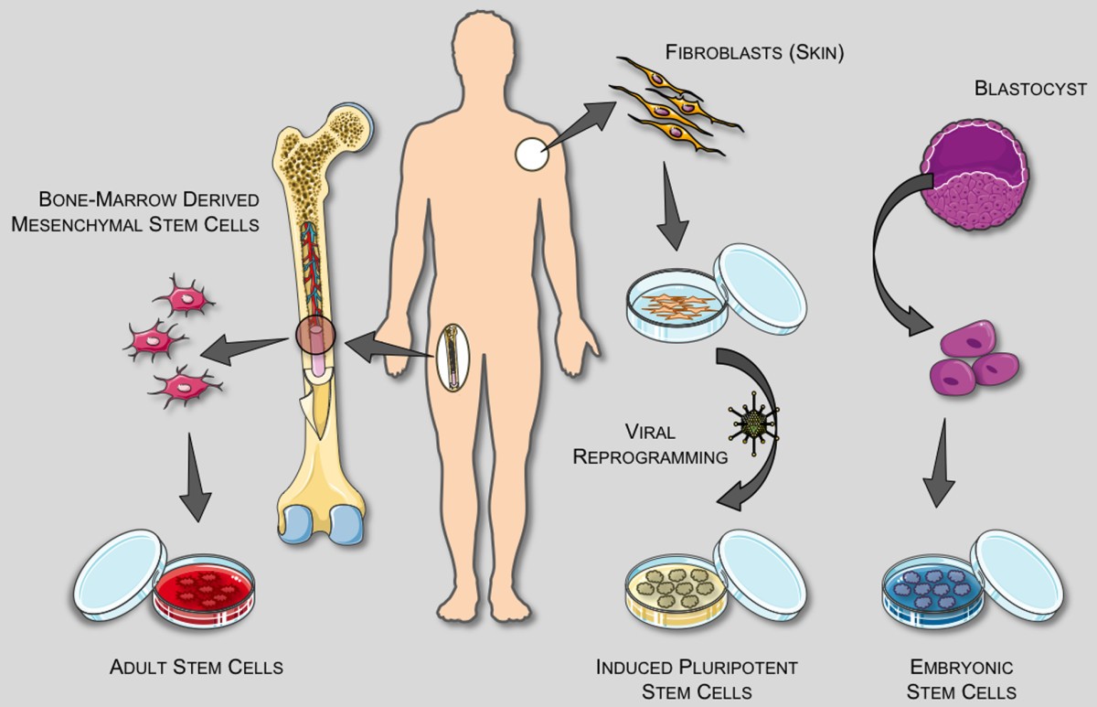 Stem cell applications in military medicine | Stem Cell Research & Therapy  | Full Text