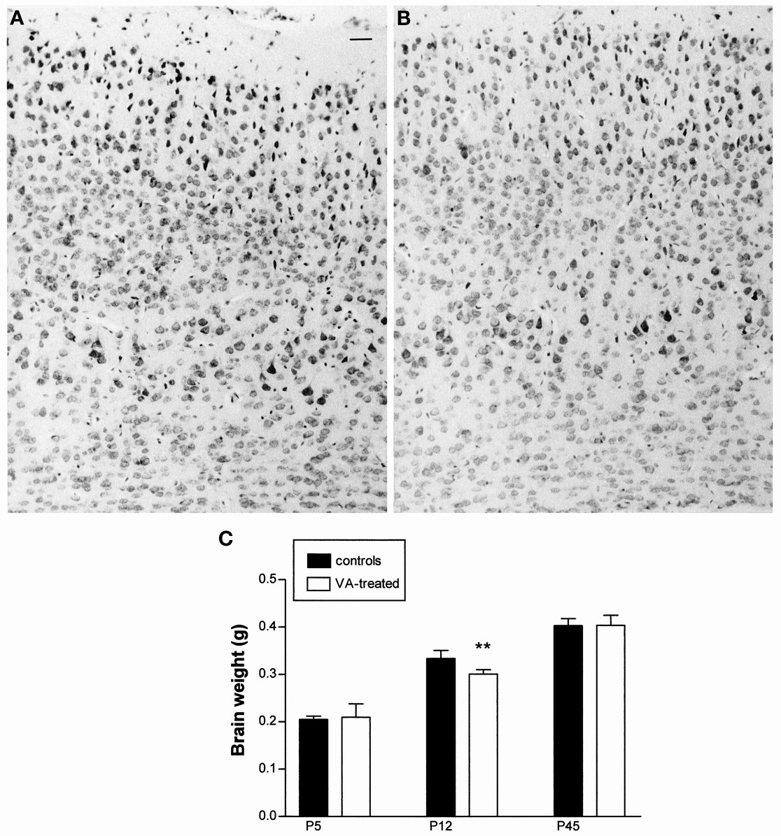 Prenatal Blockade of Vasoactive Intestinal Peptide Alters Cell Death and  Synaptic Equipment in the Murine Neocortex | Pediatric Research