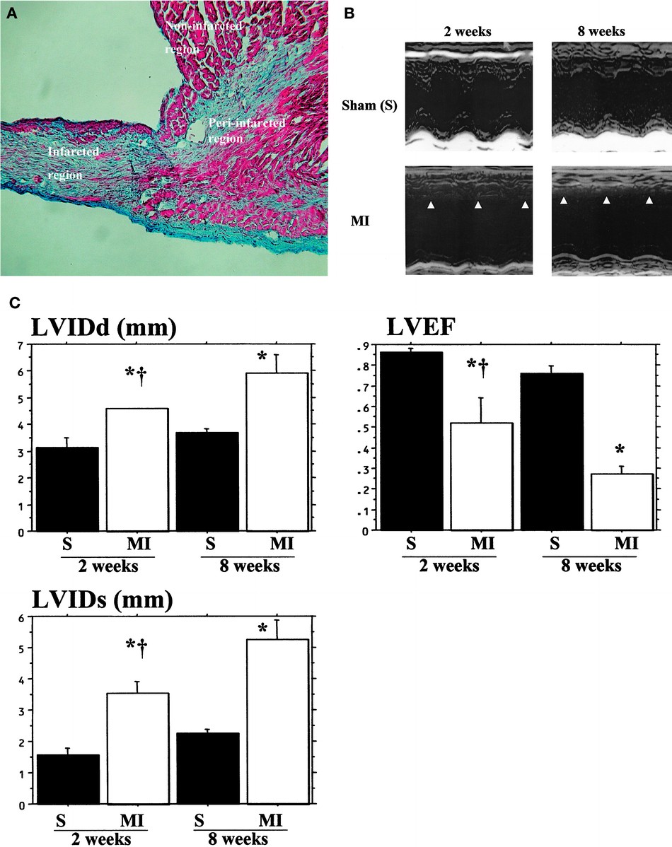 Cardiomyocyte Regeneration From Circulating Bone Marrow Cells In Mice Pediatric Research Cardiomyocyte Regeneration From Circulating Bone Marrow Cells In Mice Pediatric Research