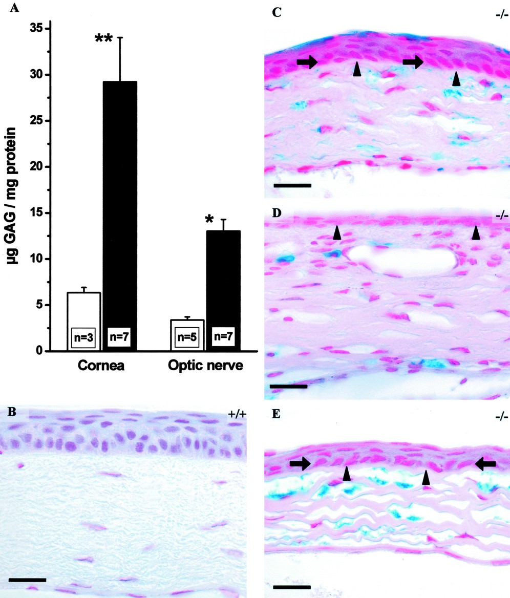 Cardiac and Ocular Pathologies in a Mouse Model of Mucopolysaccharidosis  Type VI | Pediatric Research