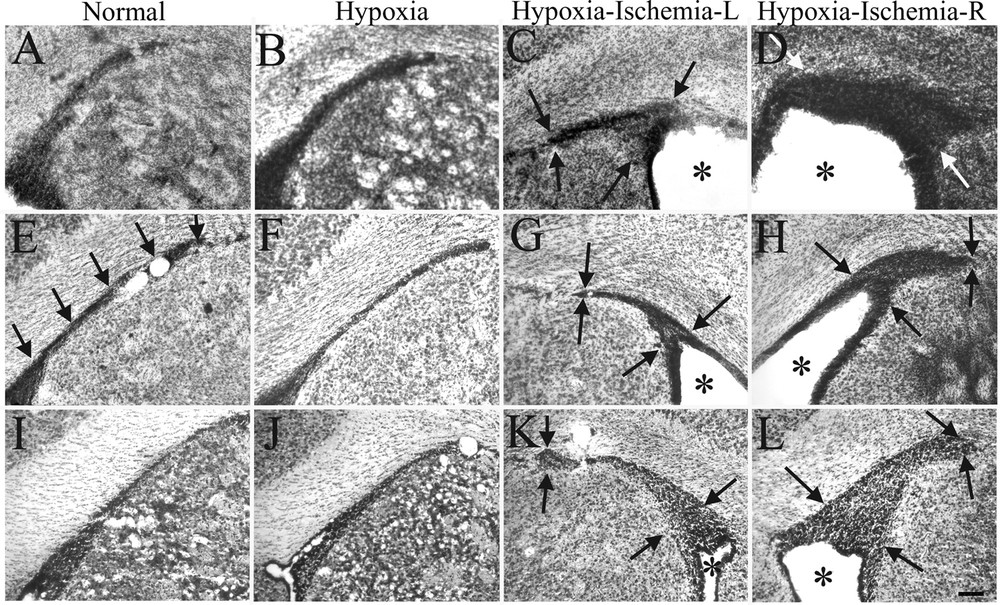 Hypoxic-Ischemic Injury Stimulates Subventricular Zone Proliferation and  Neurogenesis in the Neonatal Rat | Pediatric Research