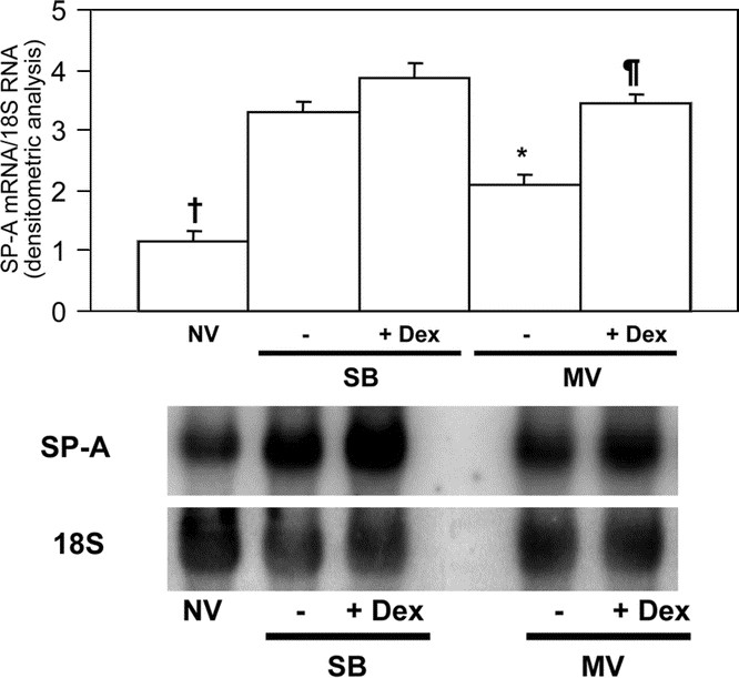 Mechanical Ventilation Down-Regulates Surfactant Protein A and Keratinocyte  Growth Factor Expression in Premature Rabbits | Pediatric Research