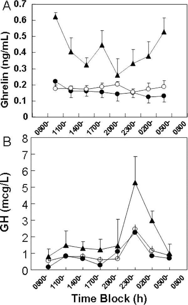 Ghrelin Concentrations Reflect Body Mass Index Rather Than Feeding Status  in Obese Girls | Pediatric Research