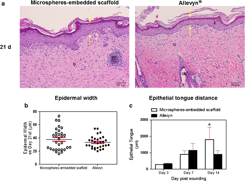 Figure 6 Controlled Release Of Chitosan And Sericin From The Microspheres Embedded Wound Dressing For The Prolonged Anti Microbial And Wound Healing Efficacy Springerlink