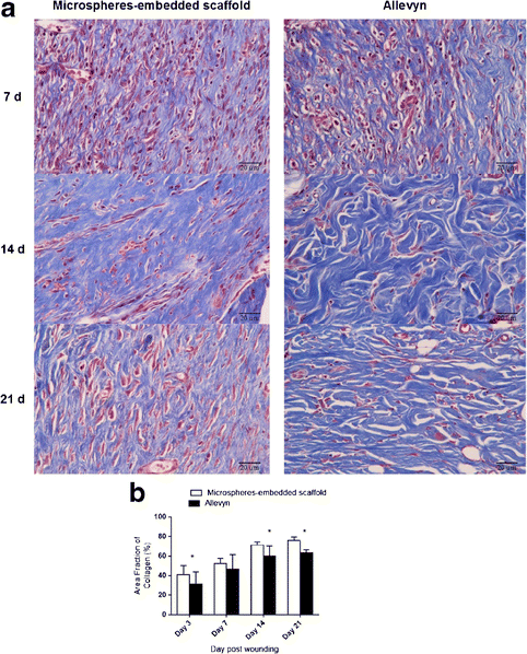 Figure 8 Controlled Release Of Chitosan And Sericin From The Microspheres Embedded Wound Dressing For The Prolonged Anti Microbial And Wound Healing Efficacy Springerlink