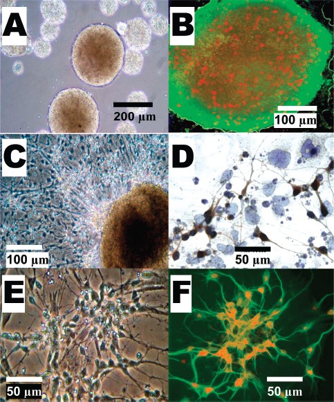 Figure 11