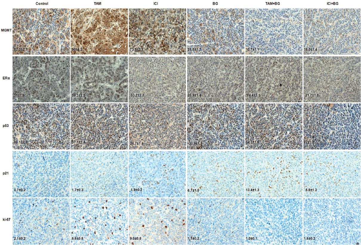 Mgmt Inhibition Res Erα Functional Sensitivity To Antiestrogen Figure 6