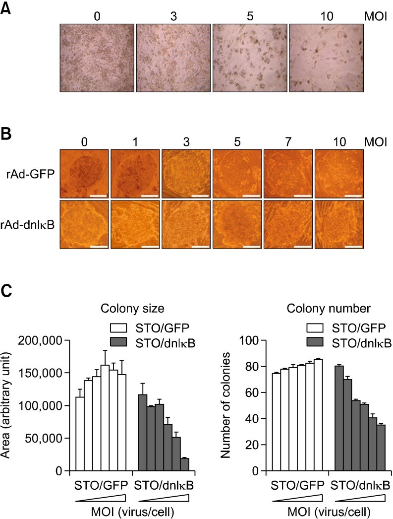 Overexpression Of Bone Morphogenetic Protein 4 In Sto Fibroblast