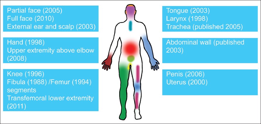 Figure 1: