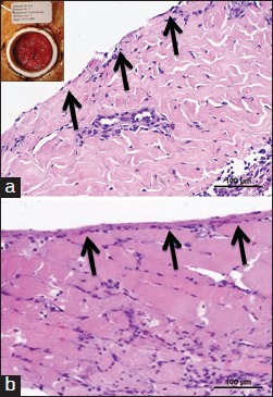 Figure 4: