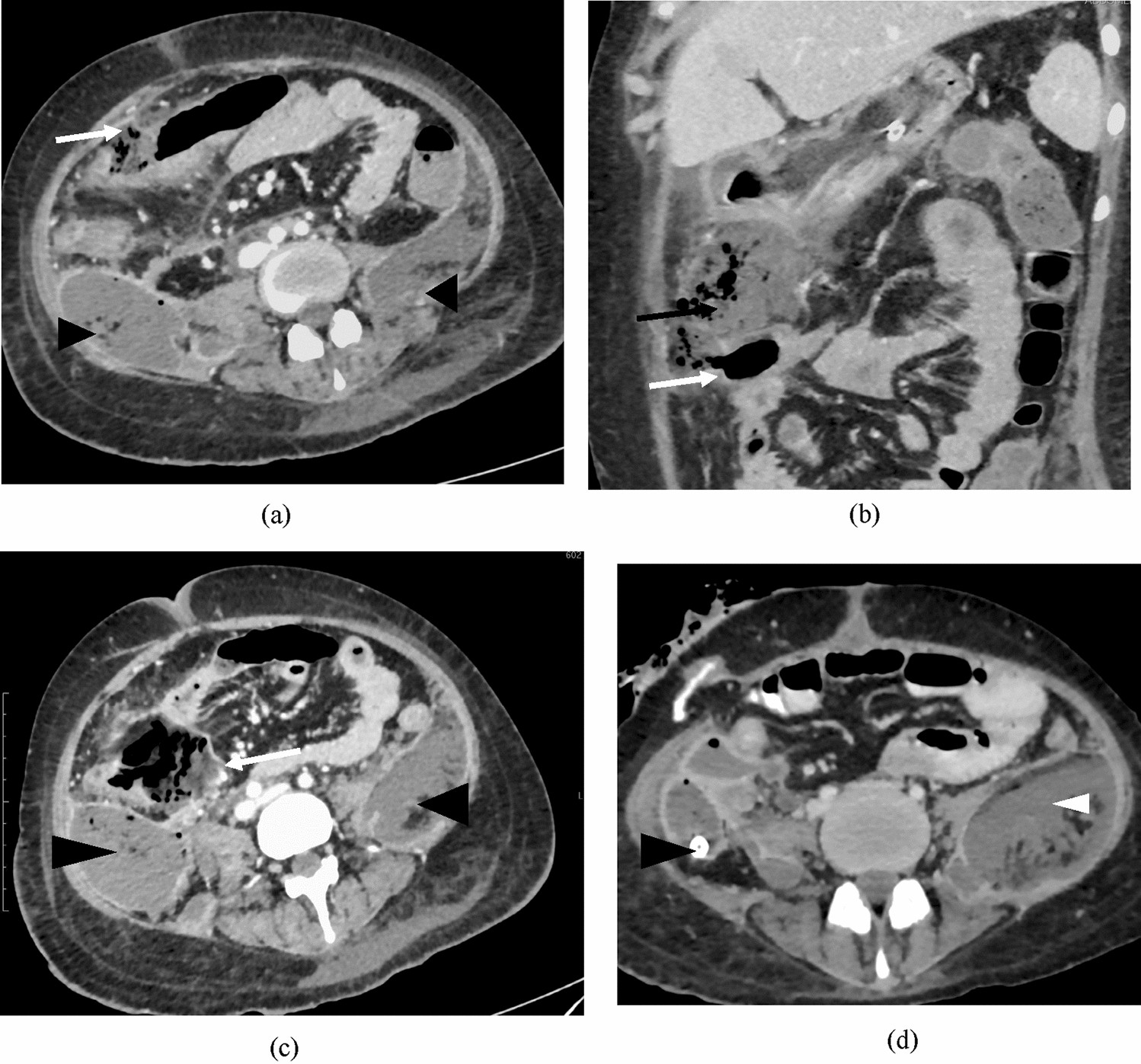 Figure 4 | CT appearance of gastrointestinal tract ...