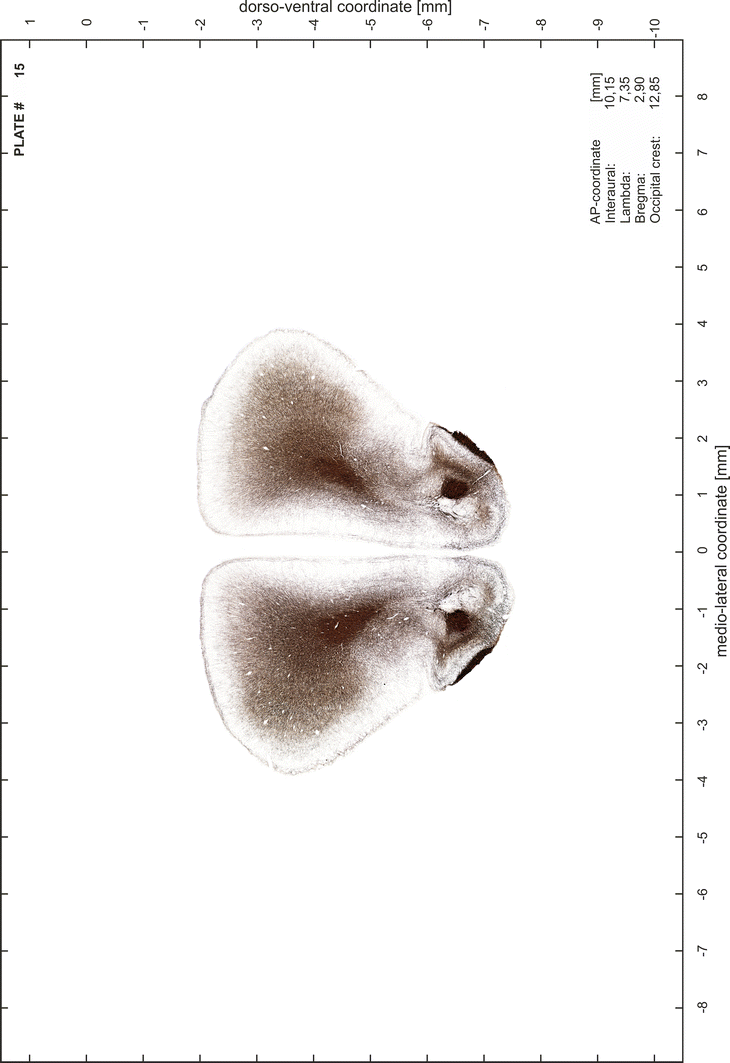 Brain atlas of the Mongolian gerbil ( Meriones unguiculatus ) in CT/MRI ...