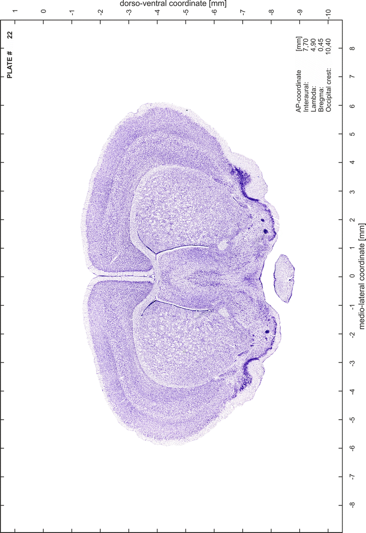 Brain atlas of the Mongolian gerbil ( Meriones unguiculatus ) in CT/MRI ...