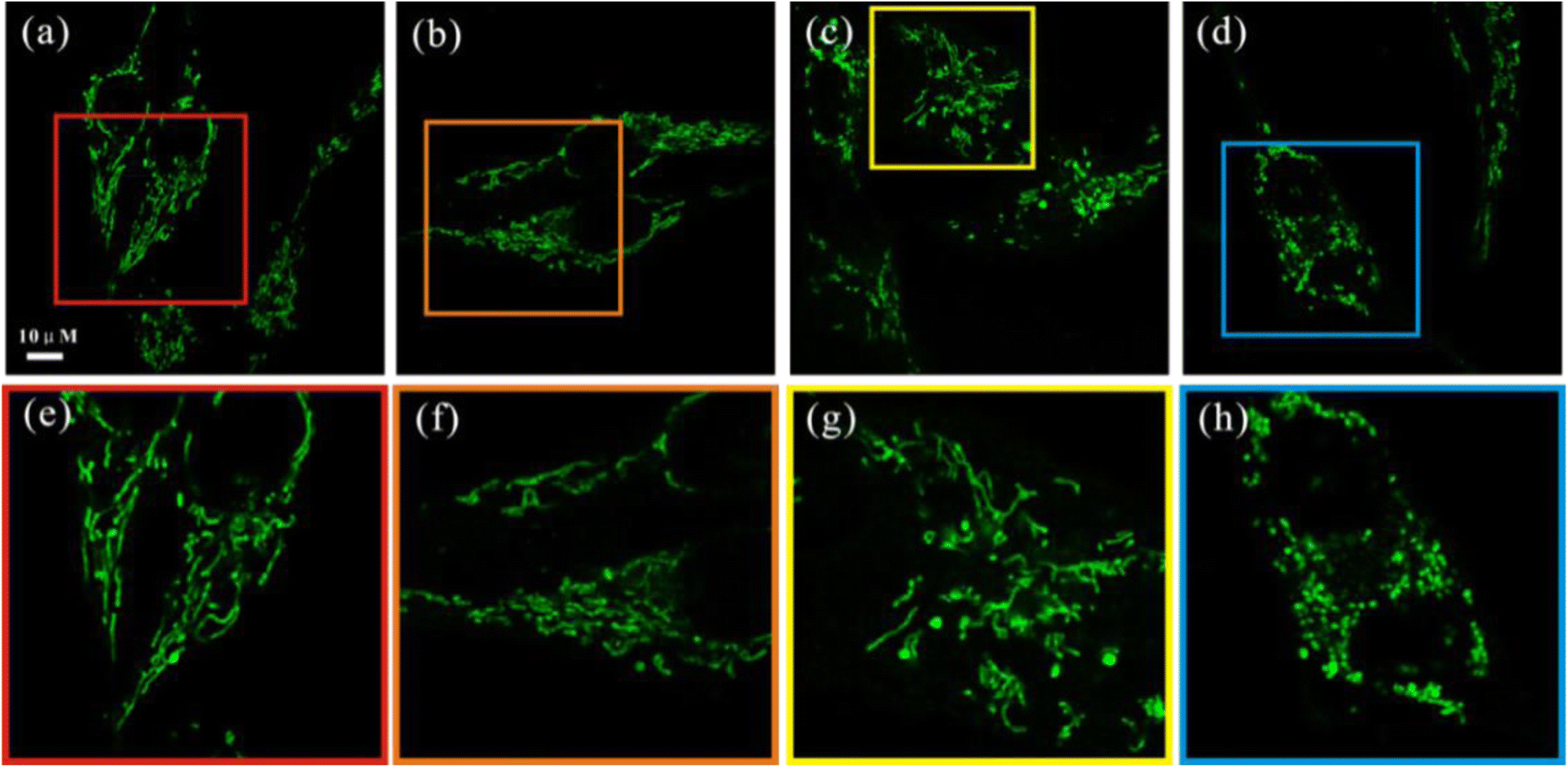 Download Figure 7 | Effect of curcumin-loaded nanoparticles on mitochondrial dysfunctions of breast ...