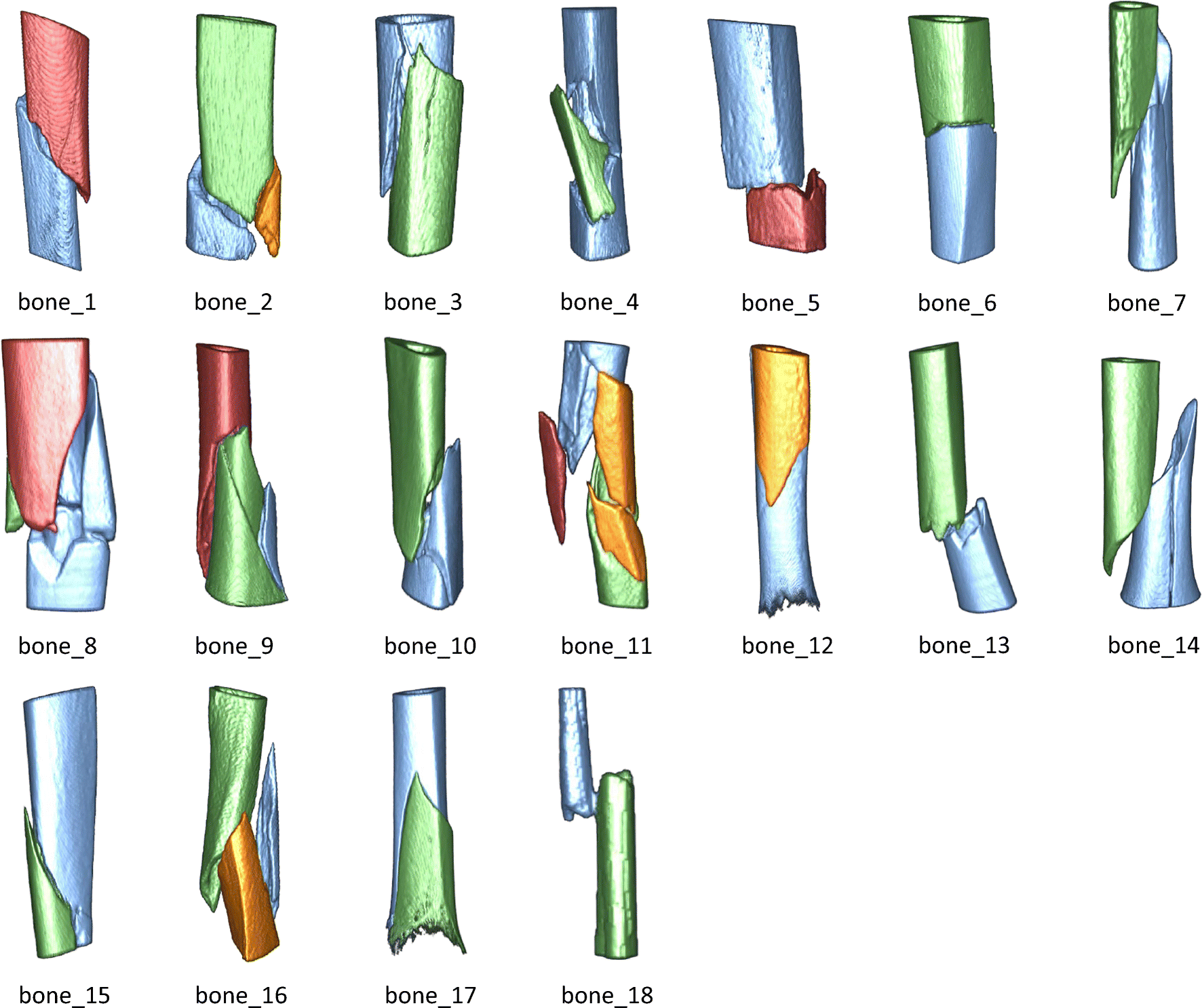 Figure 11 | Joined fragment segmentation for fractured ...