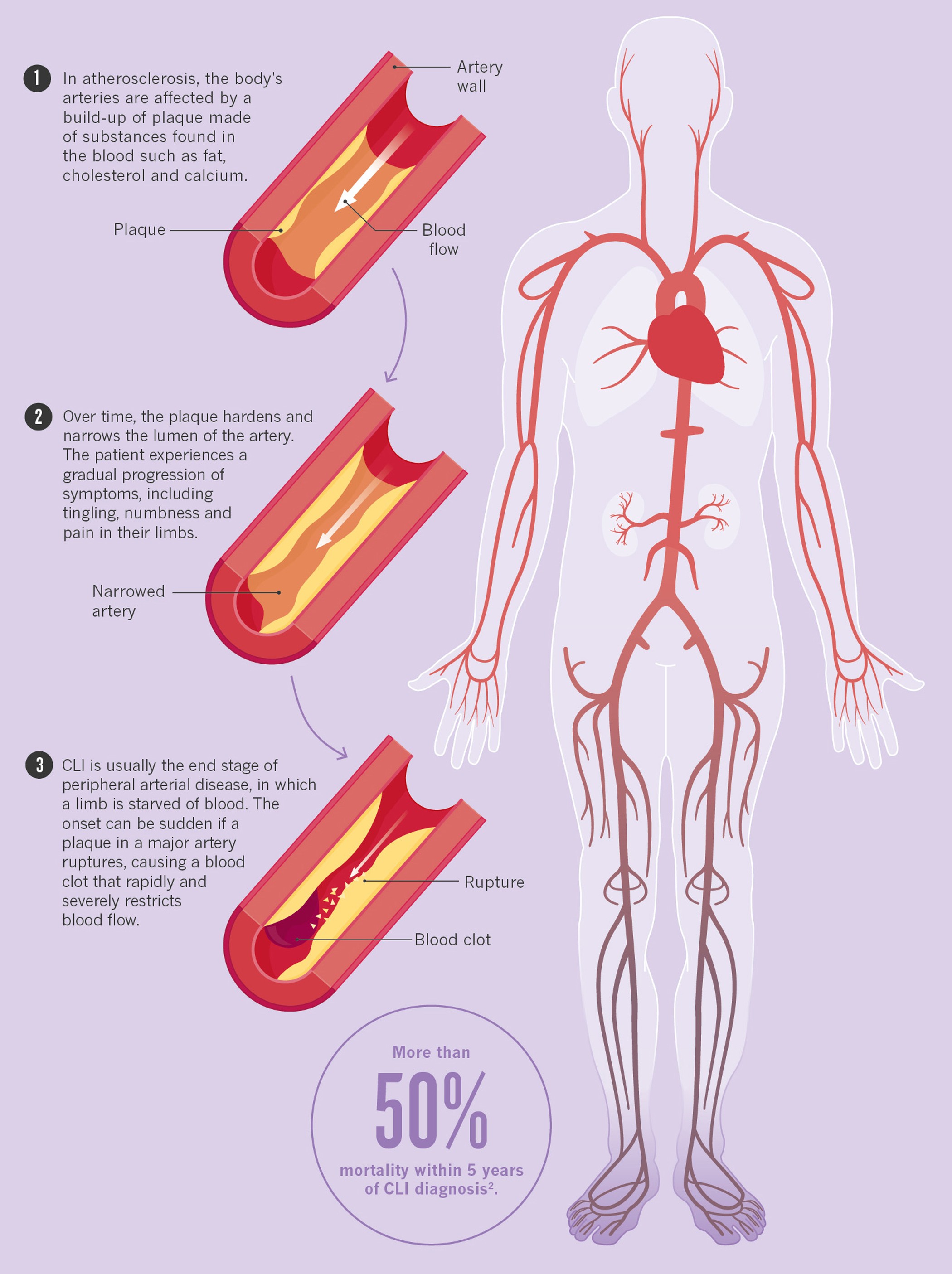 saving-life-and-limb-nature