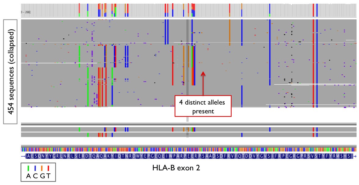 Nextgeneration sequencing for HLA typing of class I loci BMC