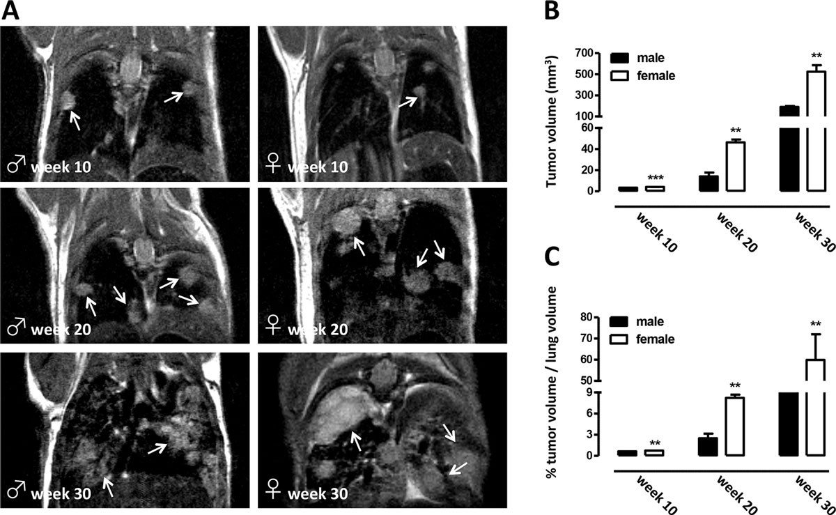 Characterization of a genetic mouse model of lung cancer: a promise to