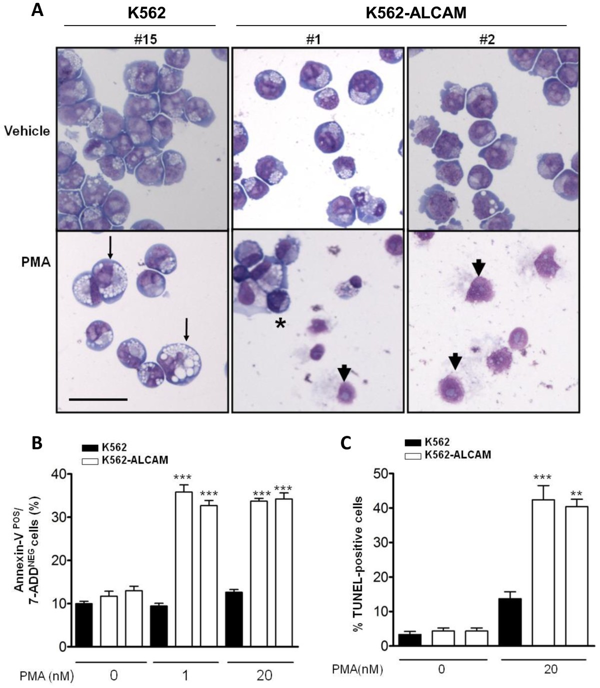 Essential role for ALCAM gene silencing in megakaryocytic