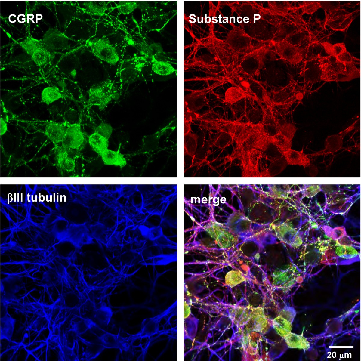 Dynamics of peptidergic secretory granule transport are regulated by