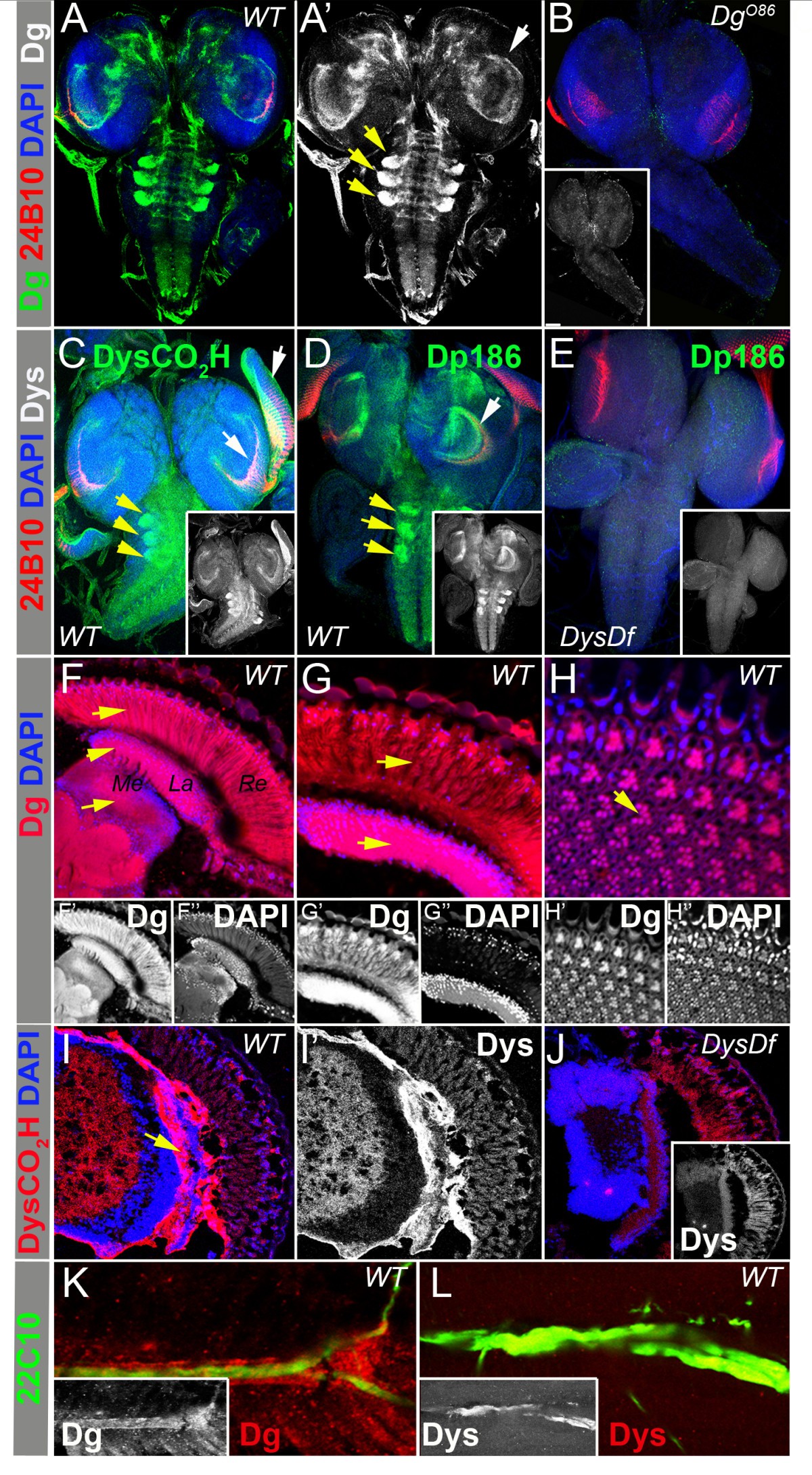 New Dystrophin/Dystroglycan interactors control neuron behavior in