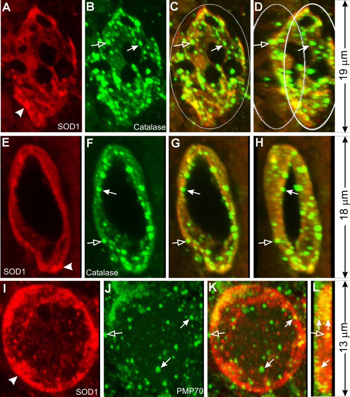 ALS-associated mutant SOD1G93A causes mitochondrial vacuolation by