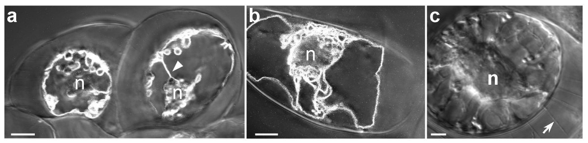 New insights into the tonoplast architecture of plant vacuoles and