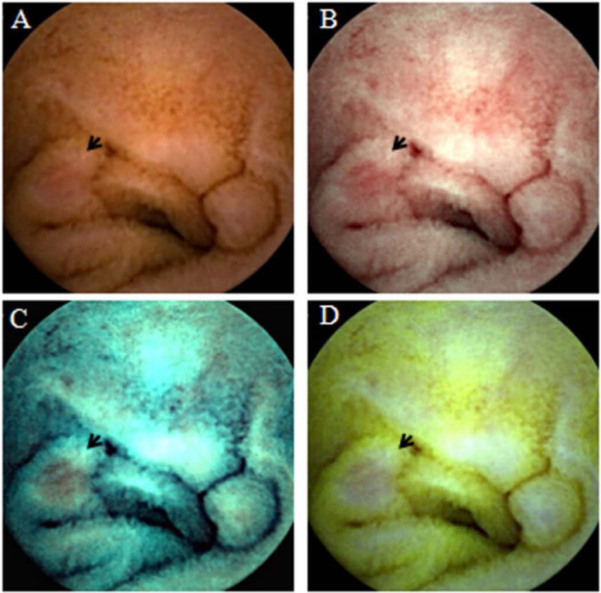 Capsule endoscopy with flexible spectral imaging color enhancement