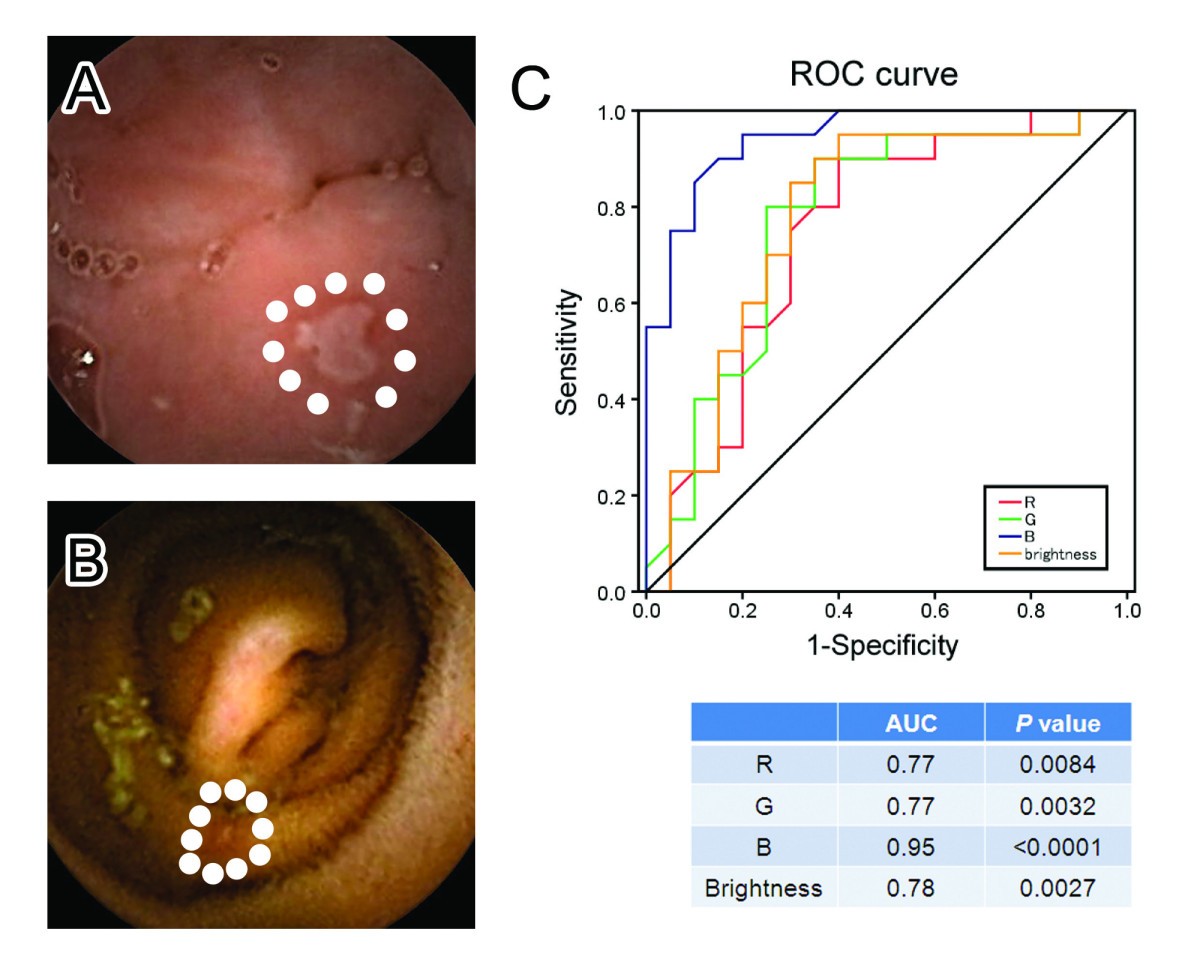 Capsule endoscopy with flexible spectral imaging color enhancement