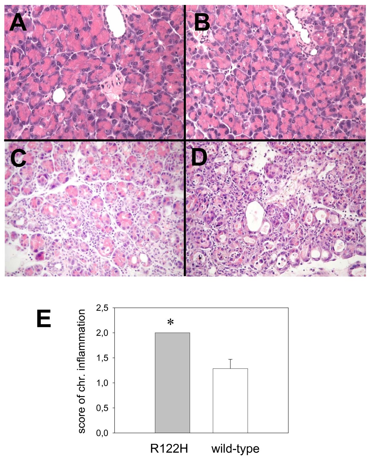 Characterisation of a transgenic mouse expressing R122H