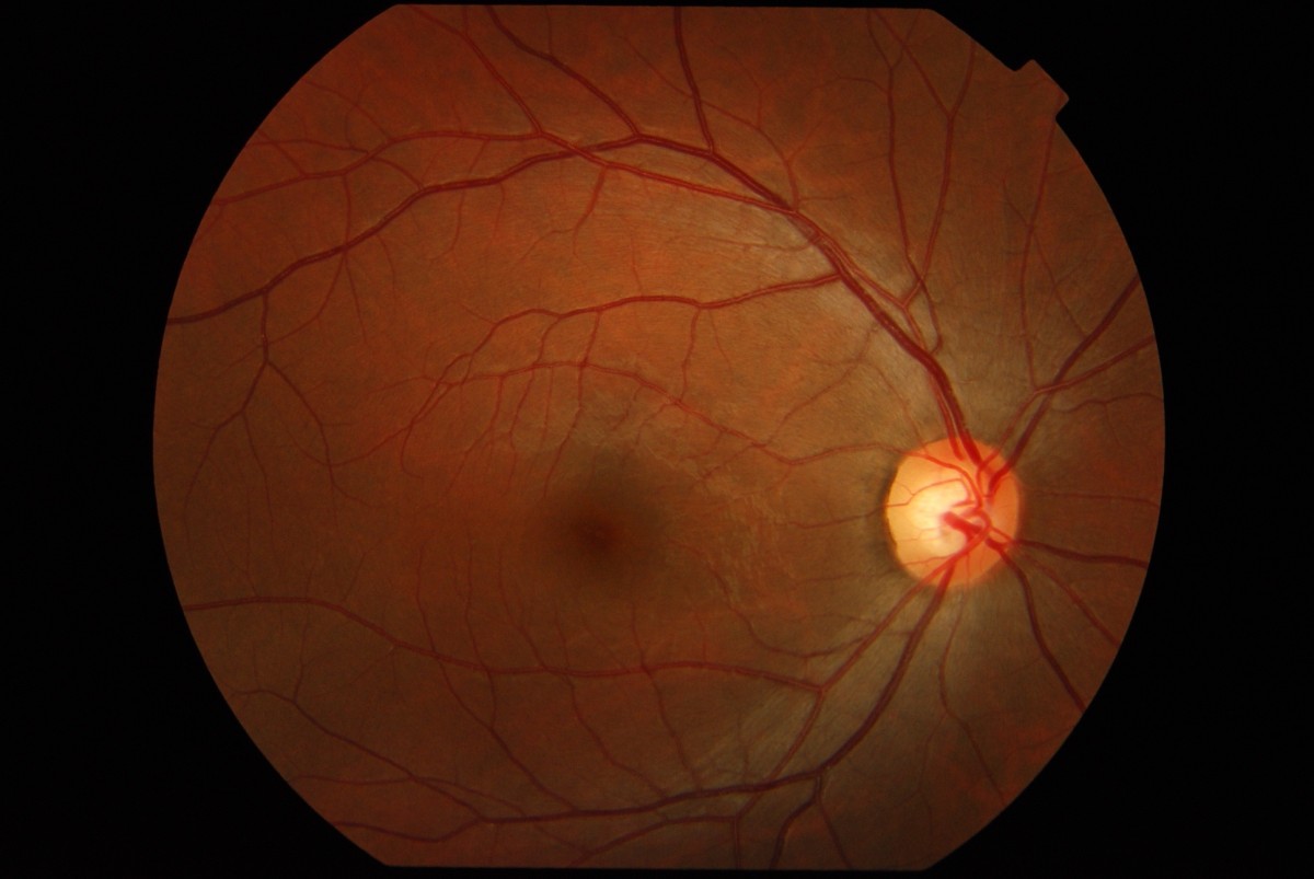 Kidney Liver Kidney Liver