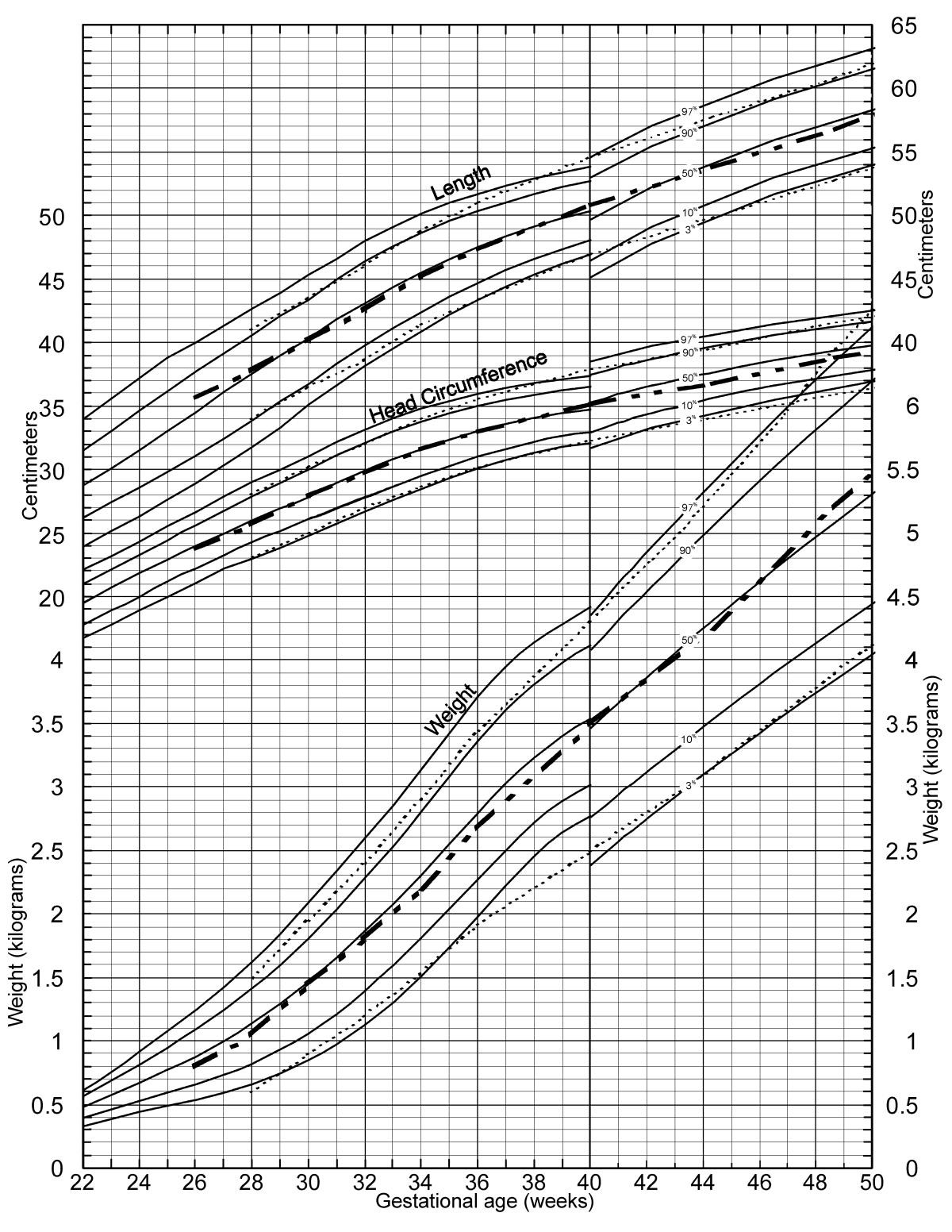 a new growth chart for preterm babies babson and benda s growth curve babies