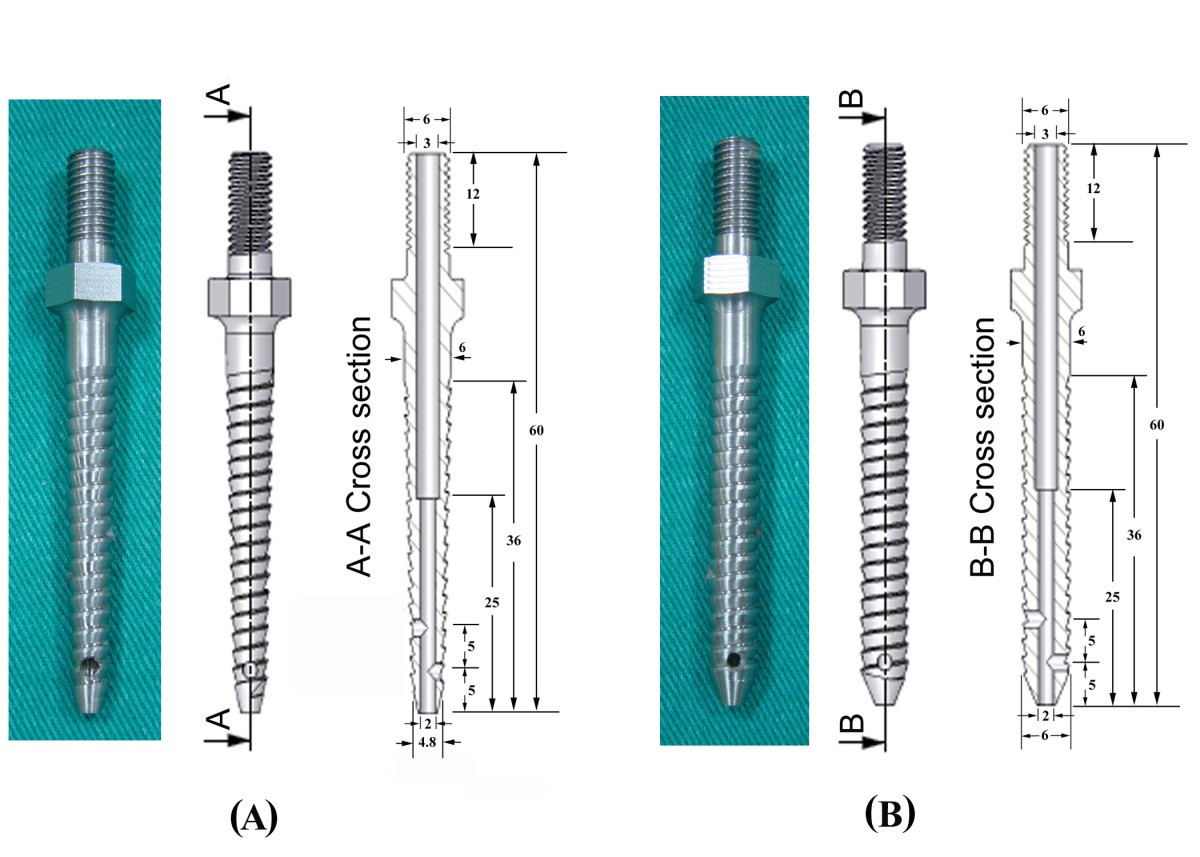 Pullout strength of pedicle screws with cement augmentation in severe