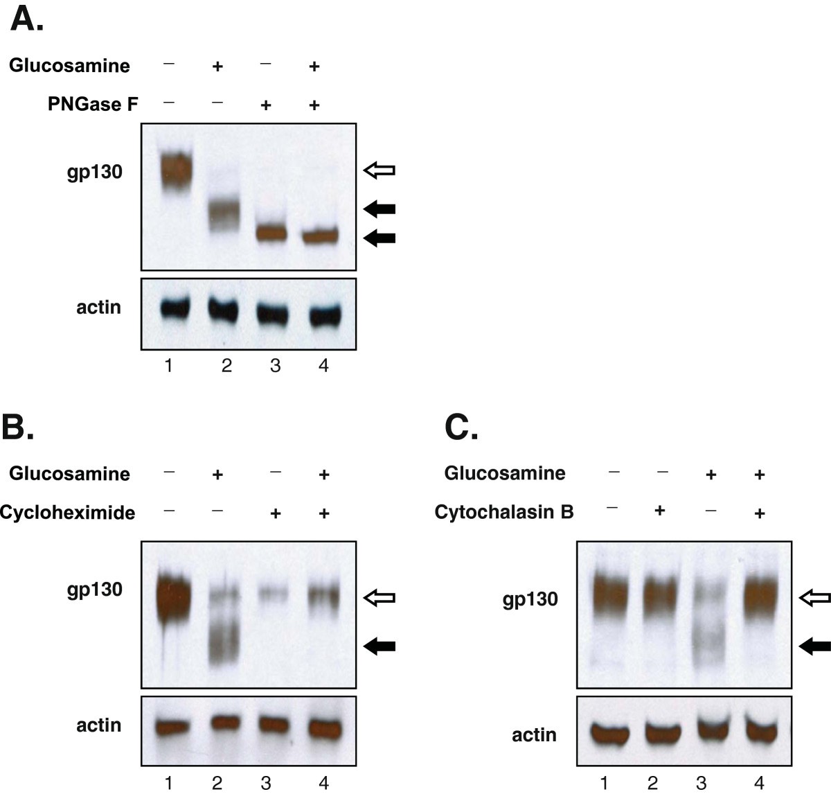Anticancer activity of glucosamine through inhibition of Nlinked