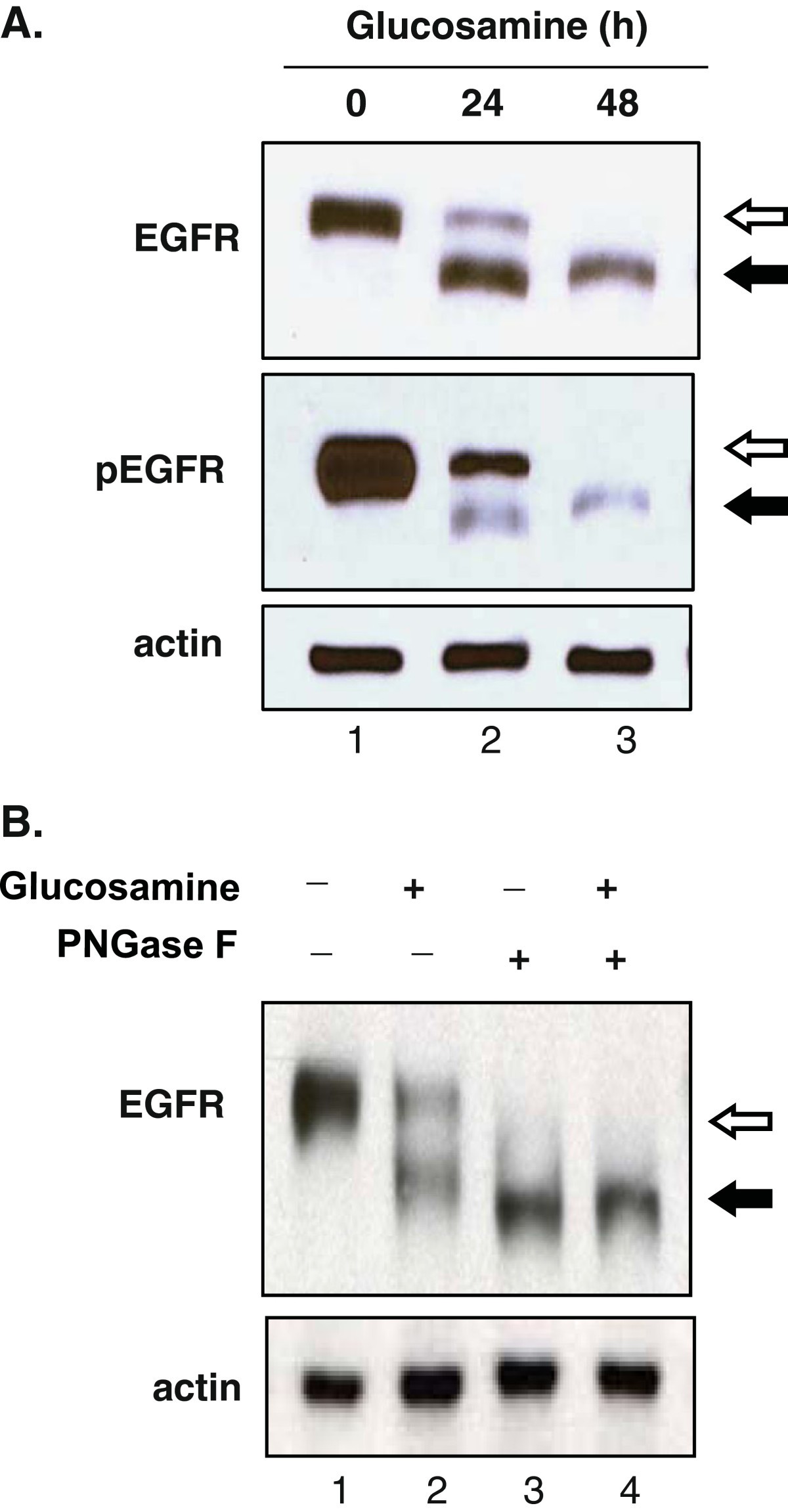 Anticancer activity of glucosamine through inhibition of Nlinked