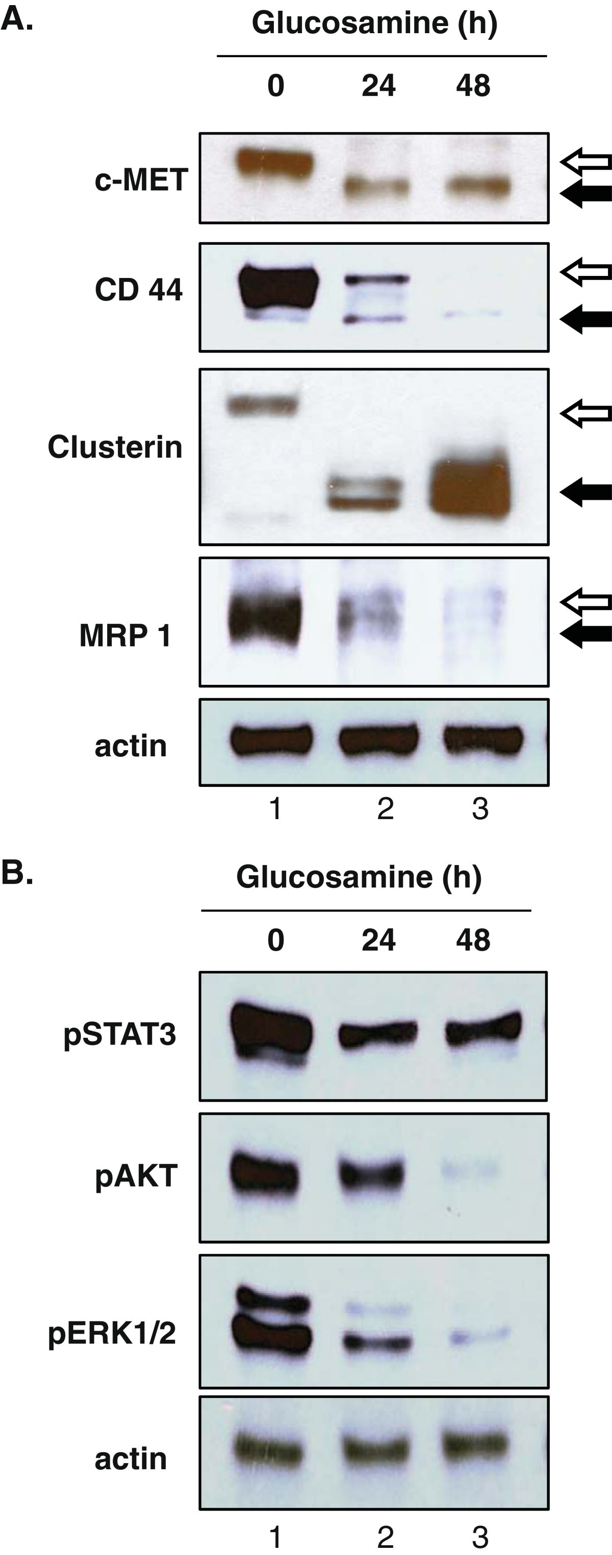 Anticancer activity of glucosamine through inhibition of Nlinked