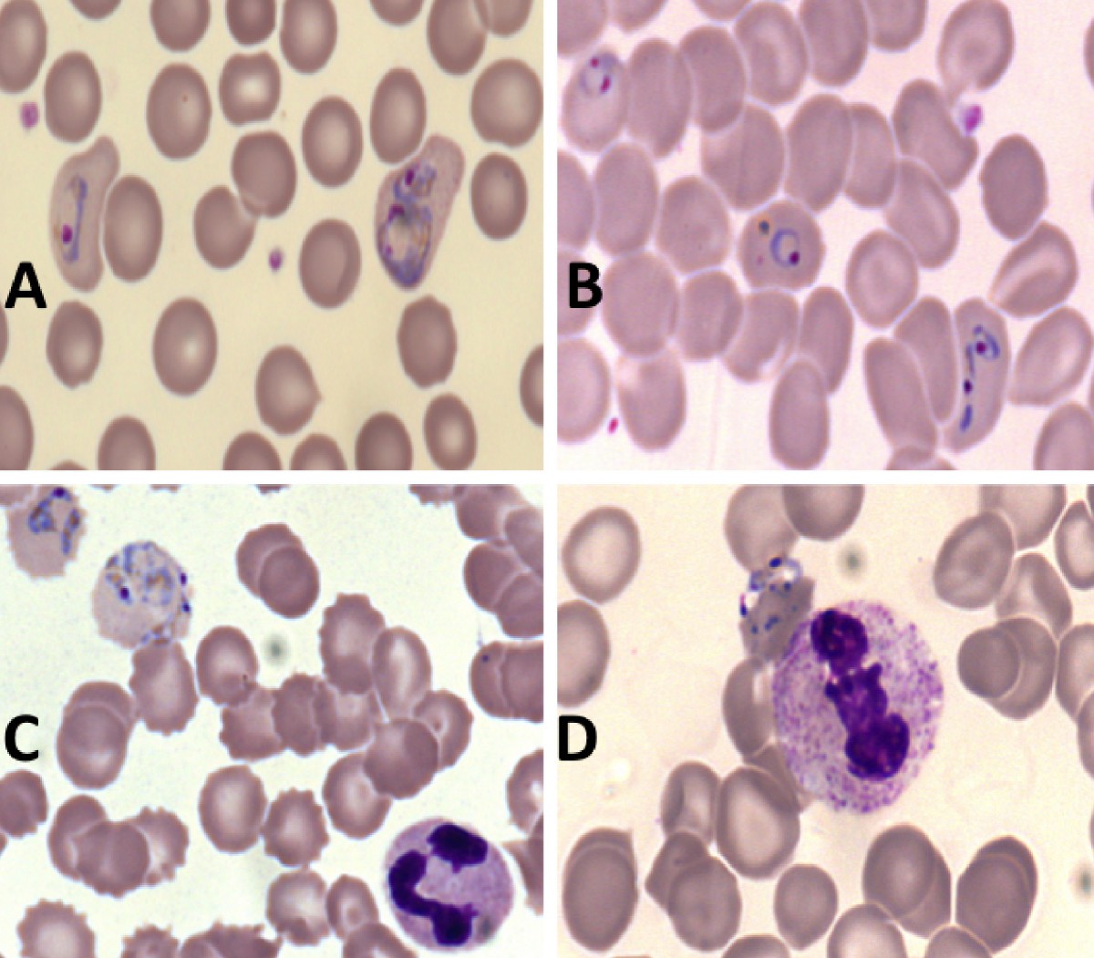 Standardization of blood smears prepared in transparent acetate an