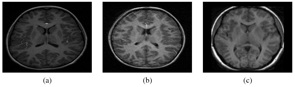 A fully-automatic caudate nucleus segmentation of brain MRI