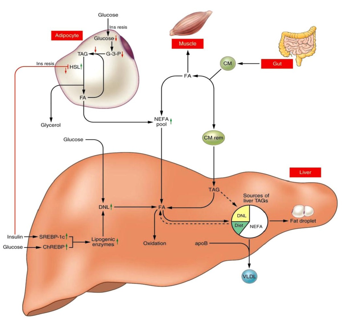 The role of hepatic fat accumulation in pathogenesis of nonalcoholic