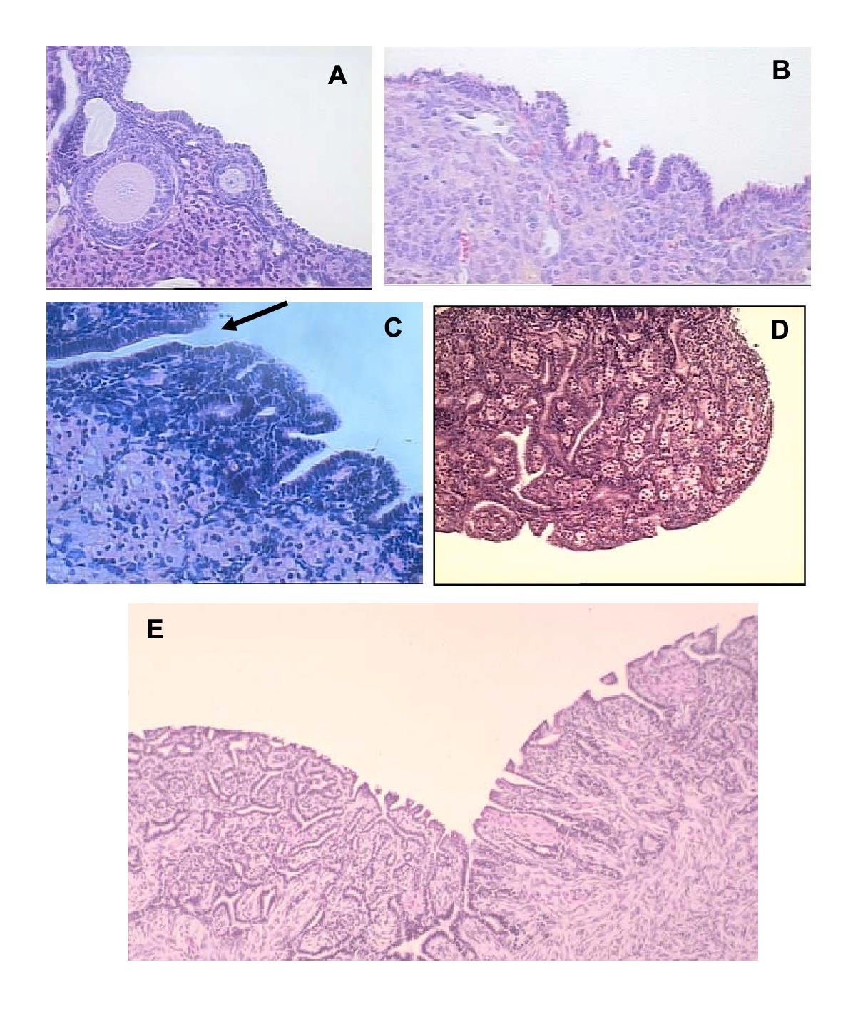 Animal models of ovarian cancer Reproductive Biology and
