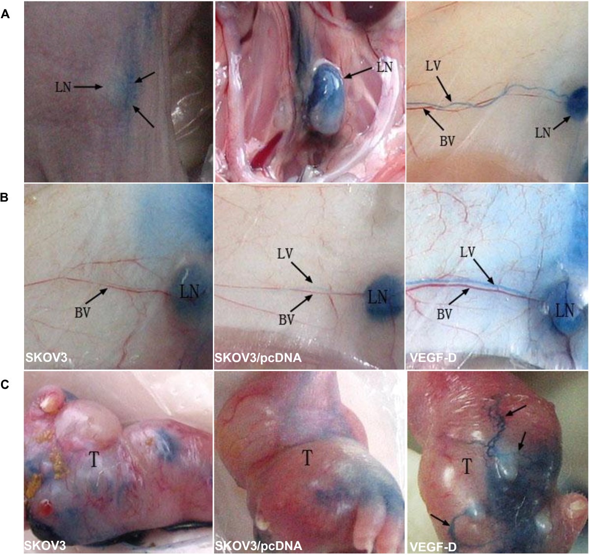 VEGF-D-induced draining lymphatic enlargement and tumor