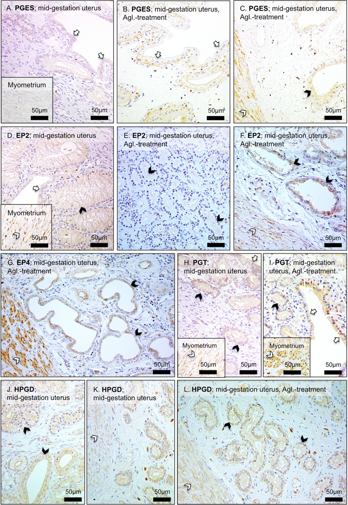 Interplacental uterine expression of genes involved in prostaglandin ...