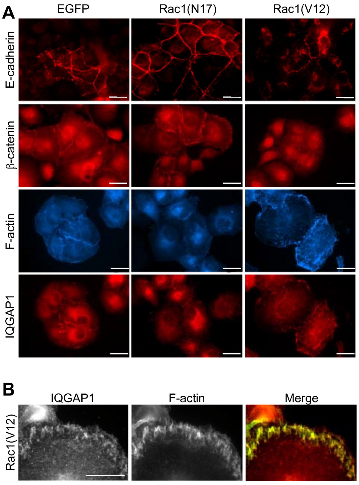 Rac1 activation inhibits Ecadherinmediated adherens junctions via