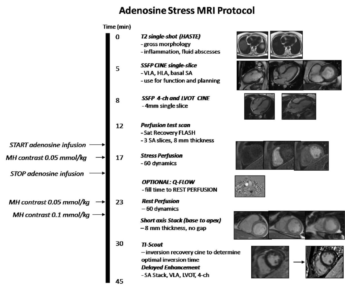 Prognostic value of adenosine stress cardiovascular resonance