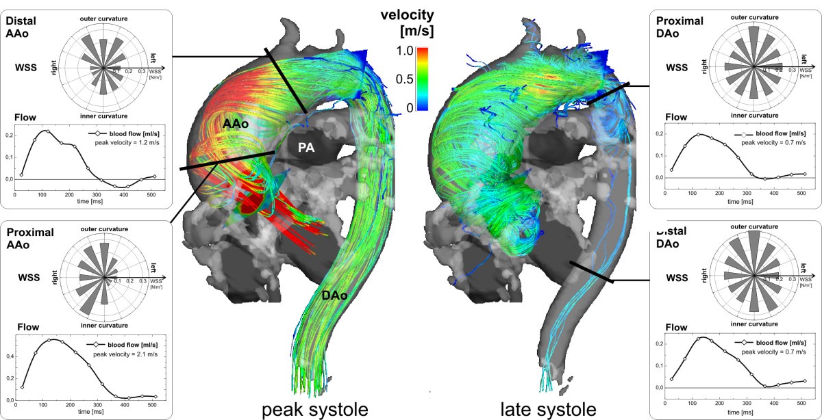 Comprehensive 4D velocity mapping of the heart and great vessels by cardiovascular
