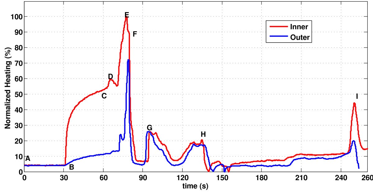 MRI active guidewire with an embedded temperature probe and providing a distinct tip signal to