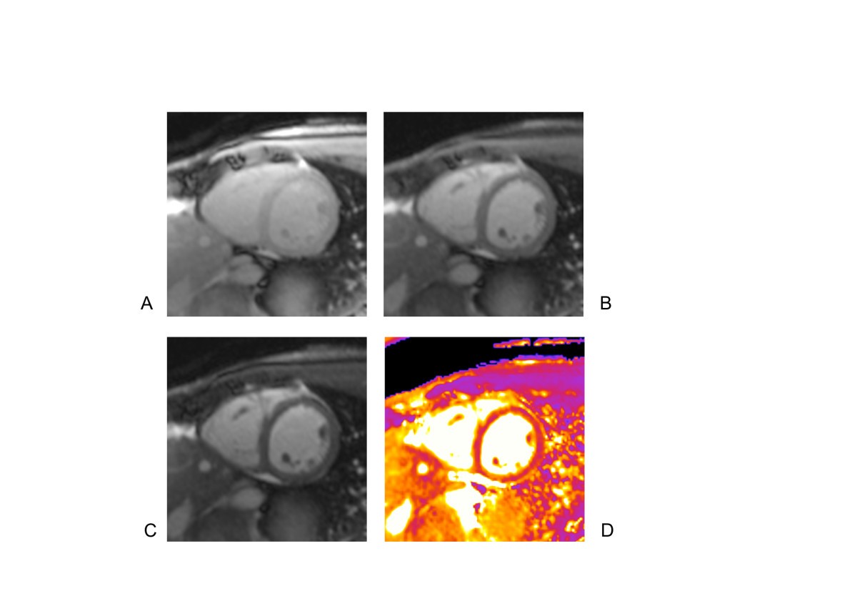 Variability and homogeneity of cardiovascular magnetic resonance ...