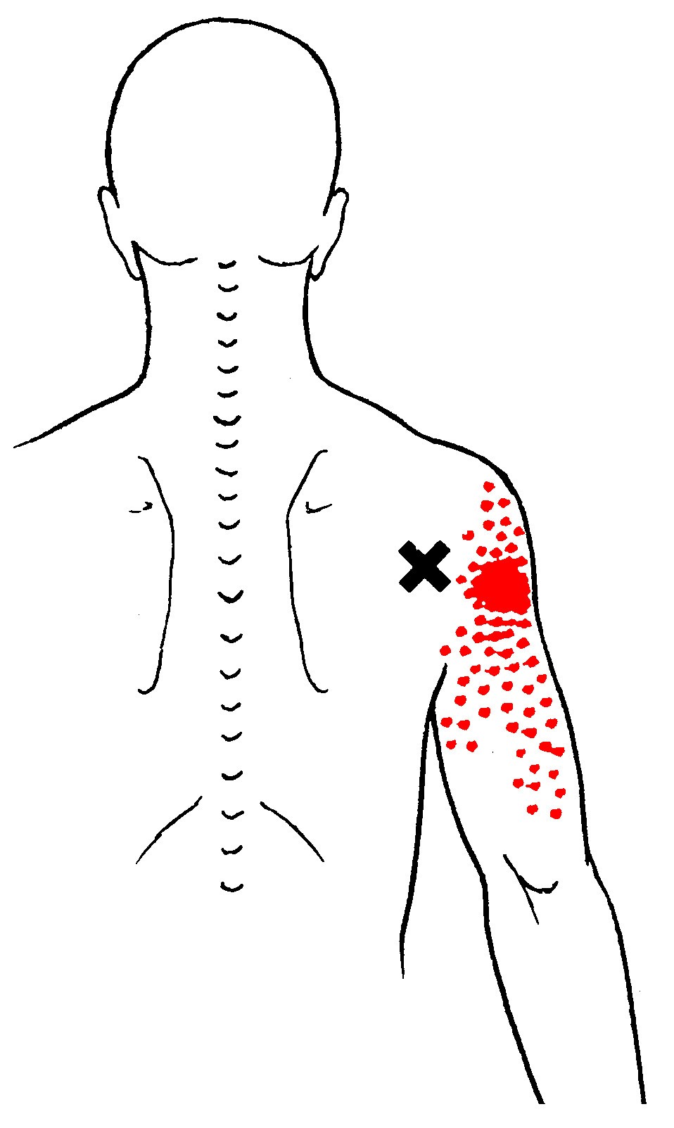 travell and simons pain patterns for heal travell and simons pain patterns for heal