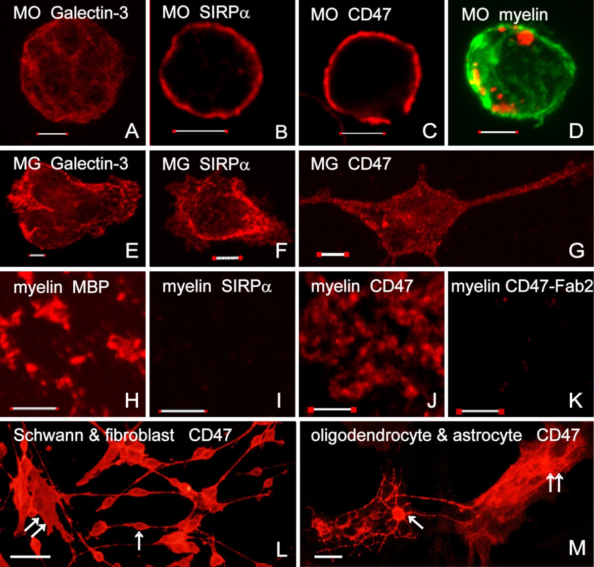Myelin downregulates myelin phagocytosis by microglia and