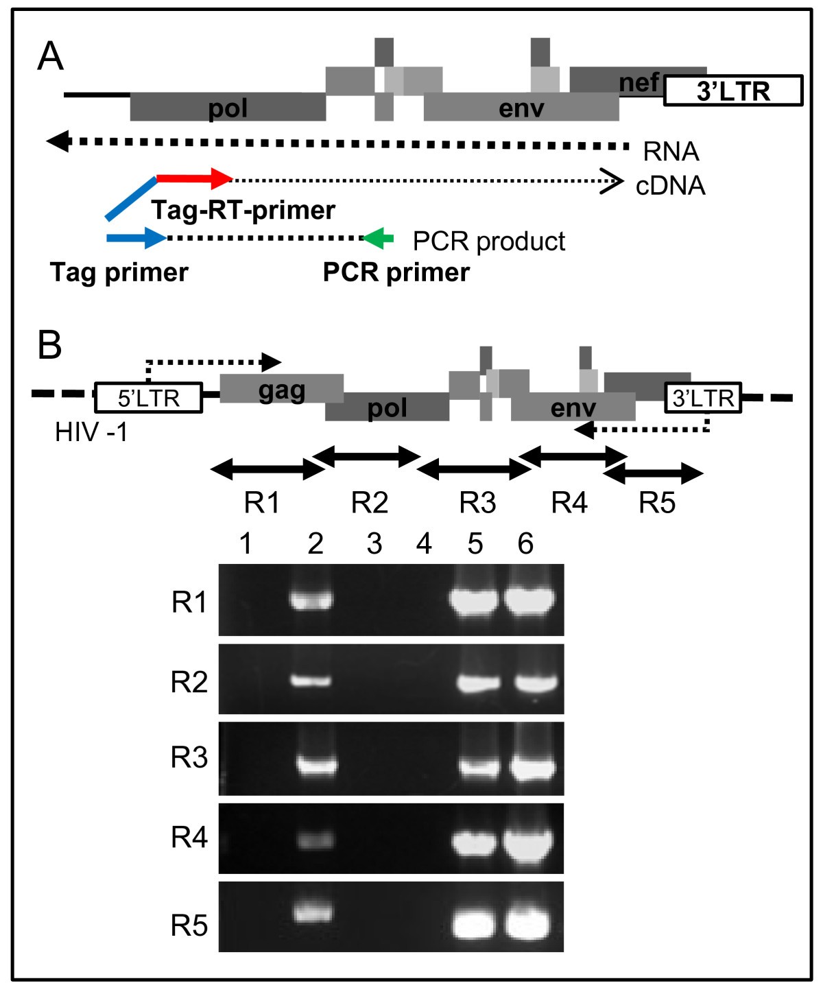 HIV1encoded antisense RNA suppresses viral replication for a